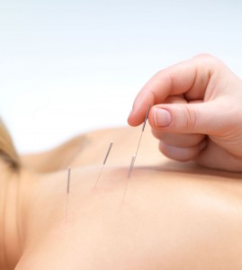 Acupuncture Benefits 