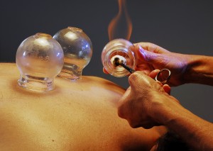 Cupping