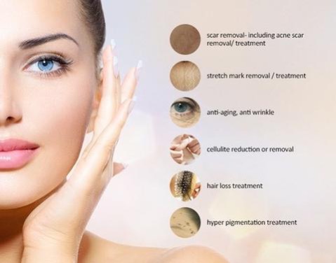 Indications for Facial Microneedling include Scar Removal, Stretch Mark Removal, Anti-Aging, Cellulite Reduction, Hair Loss, Hyper Pigmentation